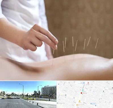 درای نیدلینگ در بلوار کلاهدوز مشهد 