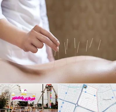 درای نیدلینگ در پادادشهر اهواز