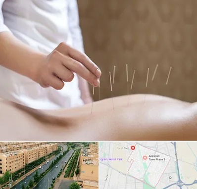 درای نیدلینگ در فاز سه اندیشه