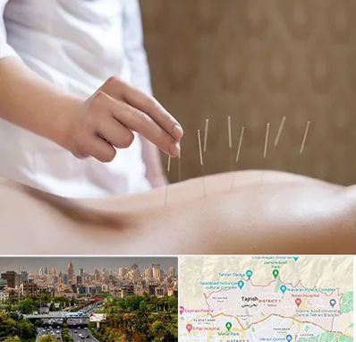 درای نیدلینگ در منطقه 1 تهران 