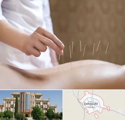 درای نیدلینگ در دهدشت