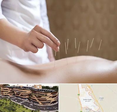 درای نیدلینگ در شاهین شهر