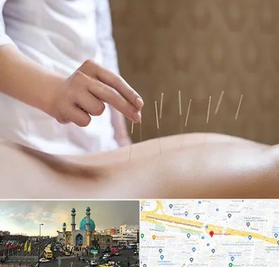 درای نیدلینگ در رسالت 