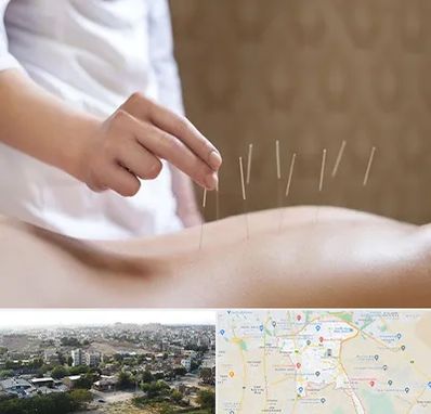 درای نیدلینگ در منطقه 20 تهران 