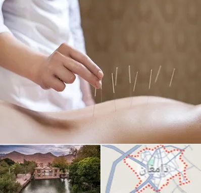 درای نیدلینگ در دامغان