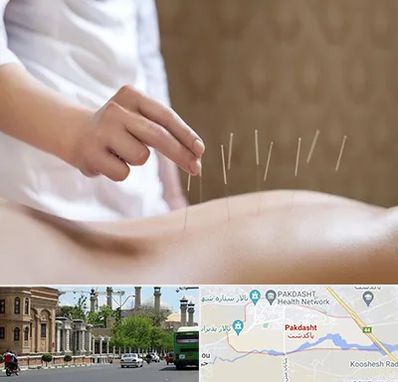 درای نیدلینگ در پاکدشت