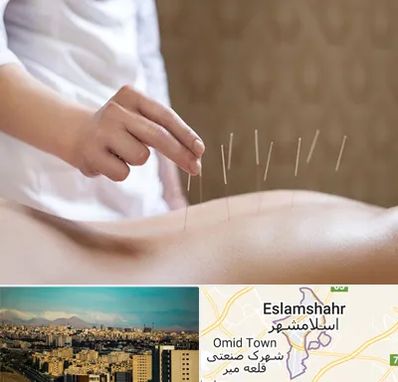 درای نیدلینگ در اسلامشهر