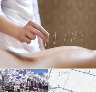 درای نیدلینگ در ازگل