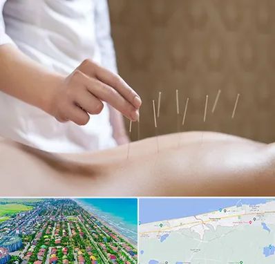 درای نیدلینگ در فریدونکنار