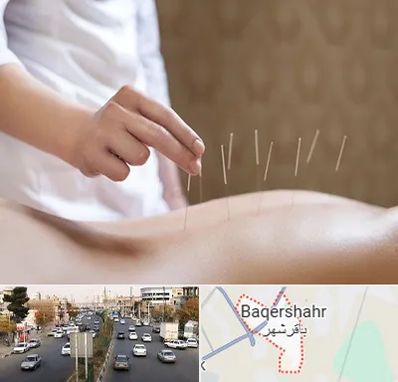 درای نیدلینگ در باقرشهر