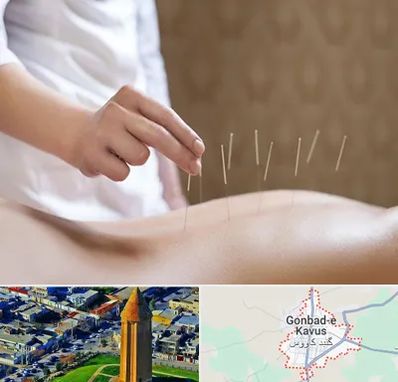 درای نیدلینگ در گنبد کاووس