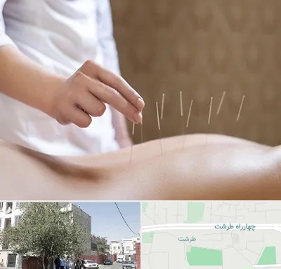 درای نیدلینگ در طرشت