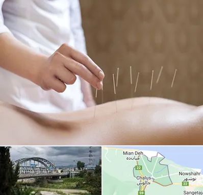 درای نیدلینگ در چالوس