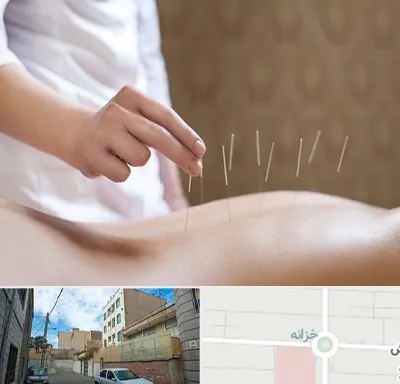 درای نیدلینگ در خزانه