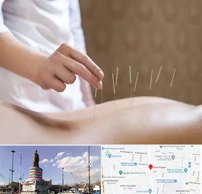 درای نیدلینگ در کارگر جنوبی 