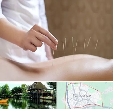 درای نیدلینگ در صومعه سرا