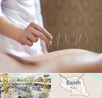 درای نیدلینگ در بانه