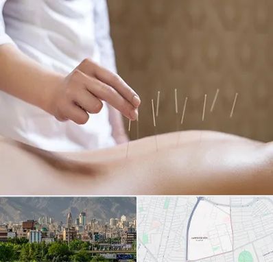 درای نیدلینگ در جمشیدیه