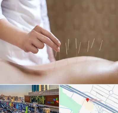 درای نیدلینگ در لاله پارک تبریز