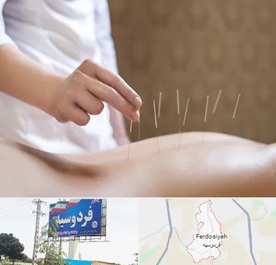 درای نیدلینگ در فردوسیه شهریار