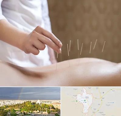 درای نیدلینگ در تربت حیدریه