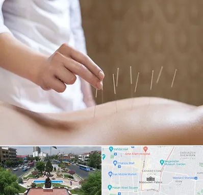 درای نیدلینگ در بهارستان 