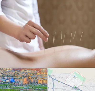 درای نیدلینگ در رشدیه تبریز