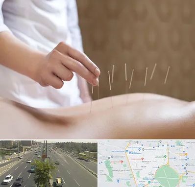 درای نیدلینگ در منطقه 17 تهران 