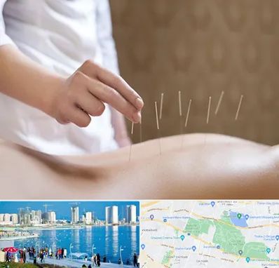 درای نیدلینگ در چیتگر 