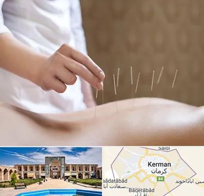 درای نیدلینگ در کرمان