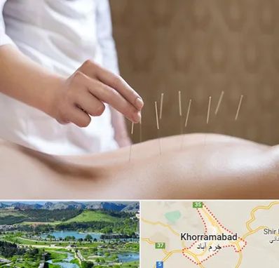 درای نیدلینگ در خرم آباد