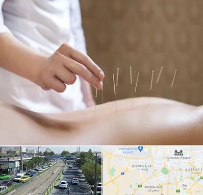 درای نیدلینگ در جنوب تهران 