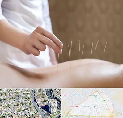 درای نیدلینگ در قاسم آباد مشهد 