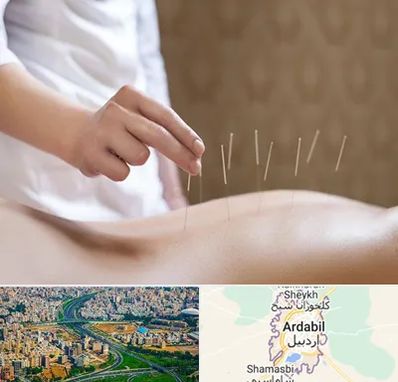 درای نیدلینگ در اردبیل