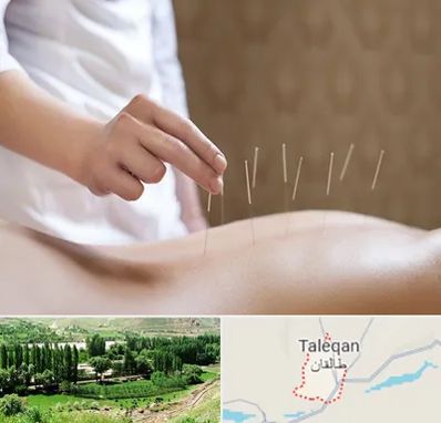 درای نیدلینگ در طالقان