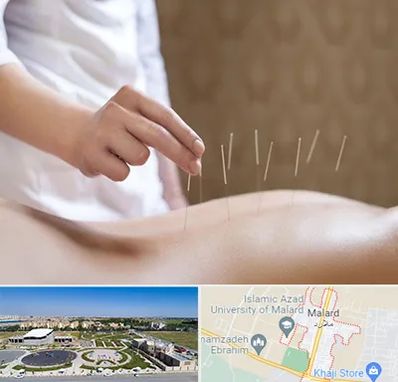 درای نیدلینگ در ملارد