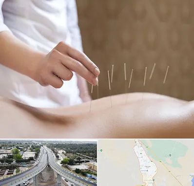 درای نیدلینگ در اندیمشک