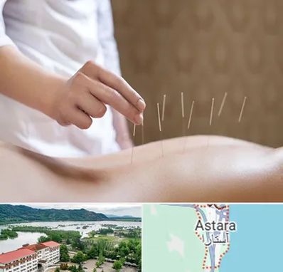 درای نیدلینگ در آستارا