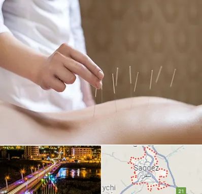 درای نیدلینگ در سقز