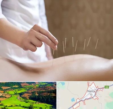 درای نیدلینگ در نکا