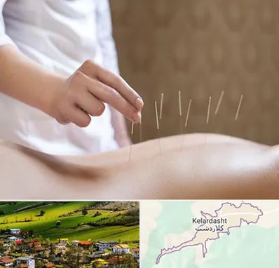 درای نیدلینگ در کلاردشت