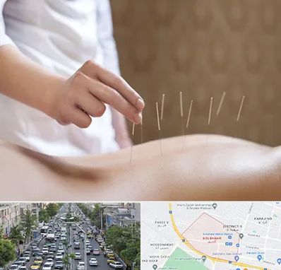 درای نیدلینگ در گلشهر کرج 