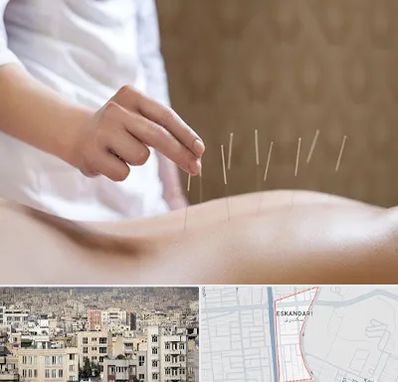 درای نیدلینگ در اسکندری