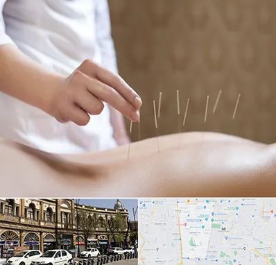 درای نیدلینگ در منطقه 11 تهران 