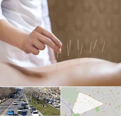 درای نیدلینگ در احمدآباد مشهد 