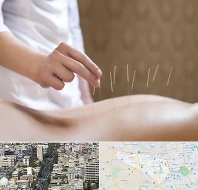 درای نیدلینگ در منطقه 18 تهران 