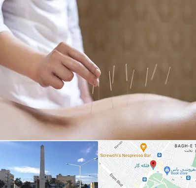 درای نیدلینگ در فلکه گاز شیراز 