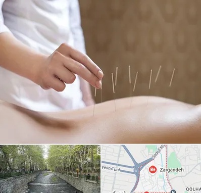 درای نیدلینگ در زرگنده
