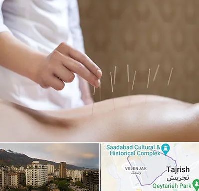 درای نیدلینگ در زعفرانیه 