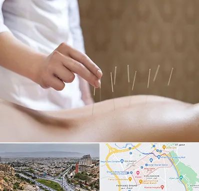 درای نیدلینگ در معالی آباد شیراز 